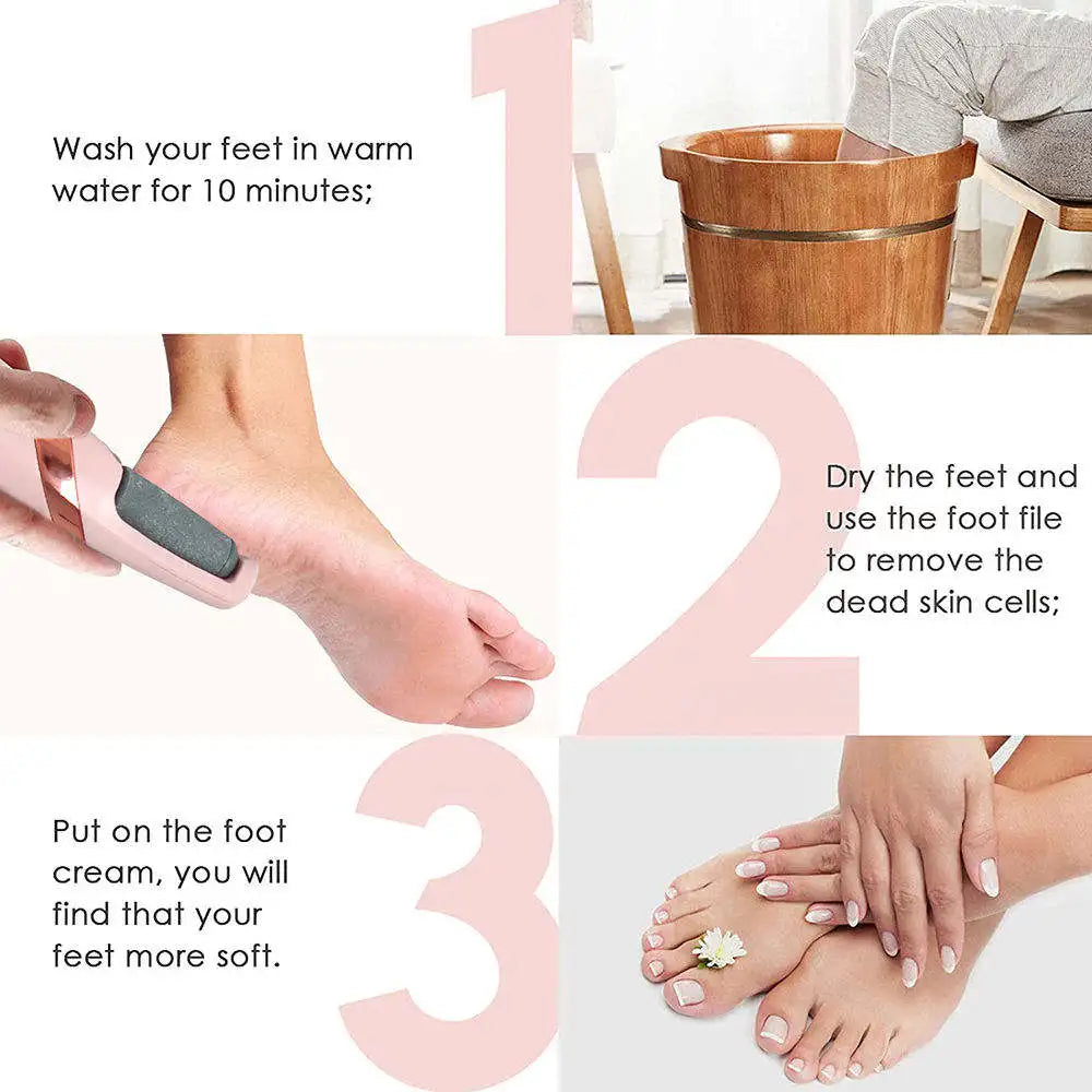 Electric Callus Remover & Foot File – Cordless Rechargeable Hard-Skin Remover with LED Light (Coarse & Fine Heads)